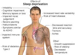 ( Sleep Deprivation - Image Courtesy of healthpromotion.caltech.edu )