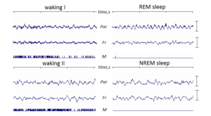 (EEG of REM sleep and NREM sleep - Image Courtesy of commons.wikimedia.org)