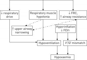 ( Pulmonary Function Analysis - Image Courtesy of err.ersjournals.com )