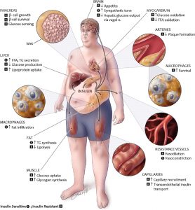 ( Metabolic Syndrome - Image Courtesy of www.livefitlean.com )