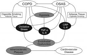 ( OSAS and COPD - Image Courtesy of www.researchgate.net )