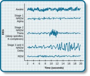 ( EEG of NREM sleep and REM sleep - Image Courtesy of cnx.org )