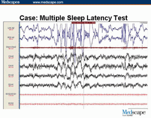 ( MSLT Multiple Sleep Latency Test - Image Courtesy of www.medscape.com )