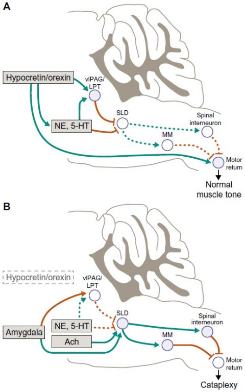 narcolepsy and cataplexy brain