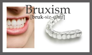 ( Bruxism - Image Courtesy of blogs.psychcentral.com )