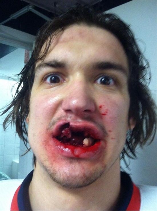 ( Do you think he was wearing a Mouth Guard??! - Image Courtesy of www.pinterest.com )