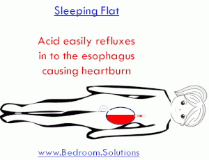 Heartburn when sleeping flat