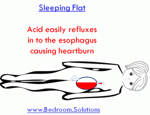acid reflux in flat sleeping position