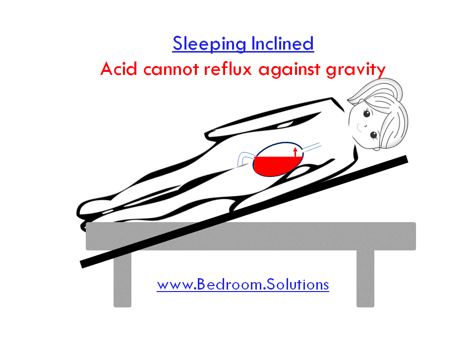 acid reflux in inclined sleeping position