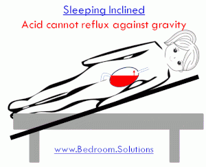 prevention of GERD by the Glideaway adjustable bed